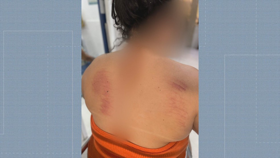 Mulher é espancada e tem casa saqueada pelo ex sob o olhar do filho de 10 anos em São Gonçalo