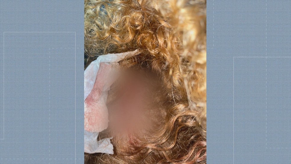 Jovem é agredida na saída de festa em Rocha Miranda por negar cantada de homem — Foto: Reprodução/ TV Globo