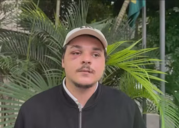Estudante de Direito é agredido após jogo no Maracanã e passa por cirurgia no Rio