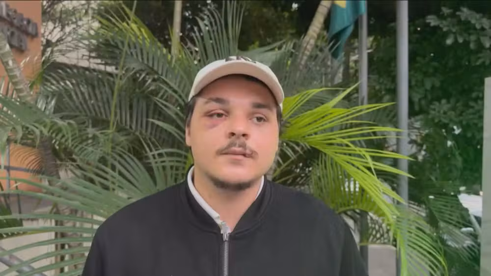 Estudante de Direito é agredido após jogo no Maracanã e passa por cirurgia no Rio