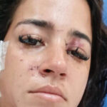 Mulher é esfaqueada na porta de casa na Praça Seca; família aponta sogra e amante do marido como suspeitas