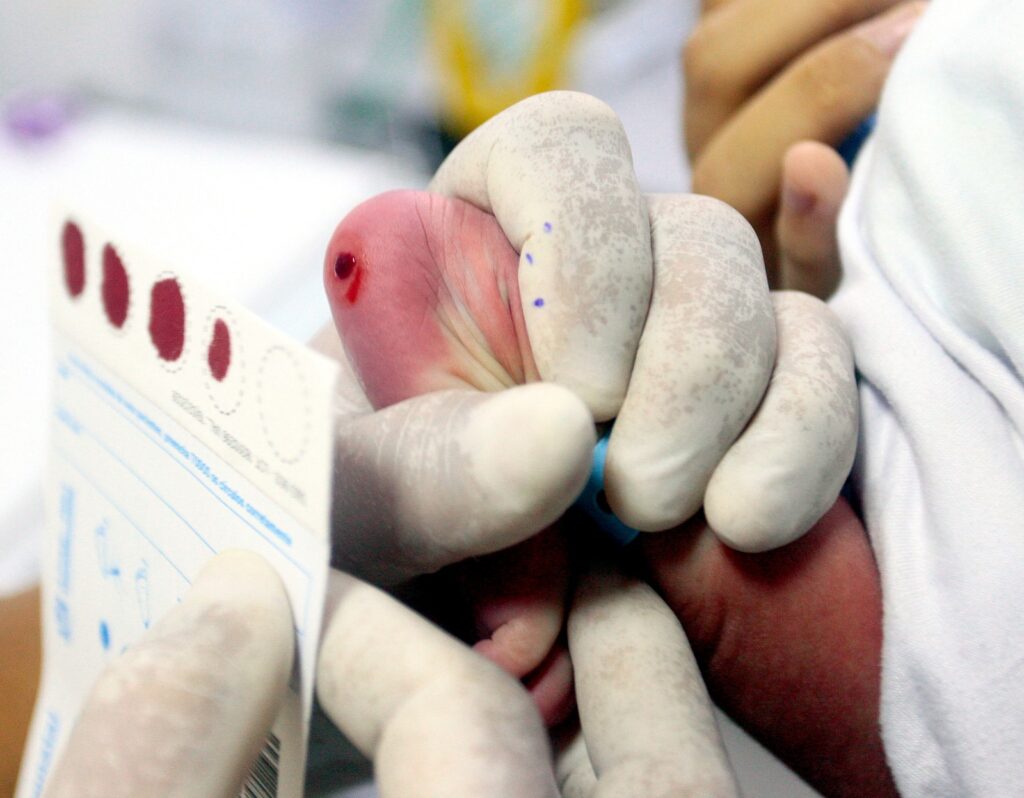 Hospital Iguassú já realizou mais de 4,5 mil testes do pezinho e reforça importância do diagnóstico precoce