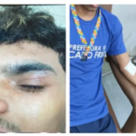 Adolescente autista é agredido dentro de escola em Cabo Frio, denuncia família
